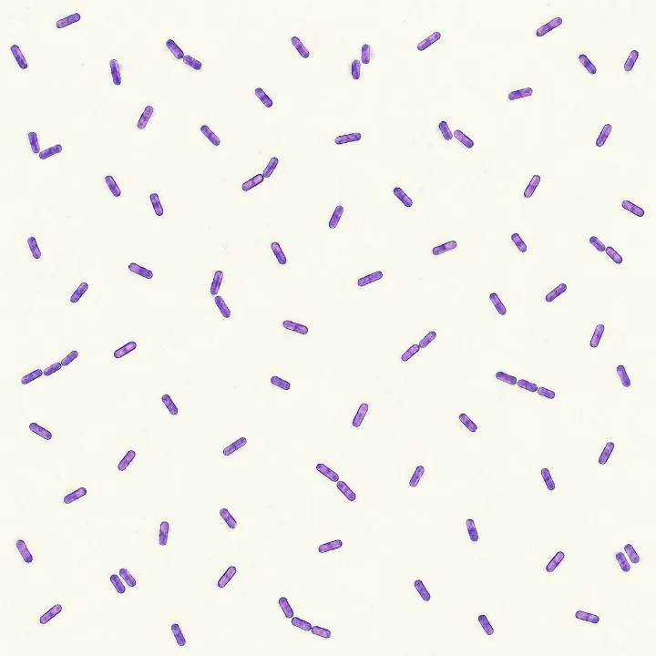 Many purple rod-shaped cells: bacteria under the microscope.